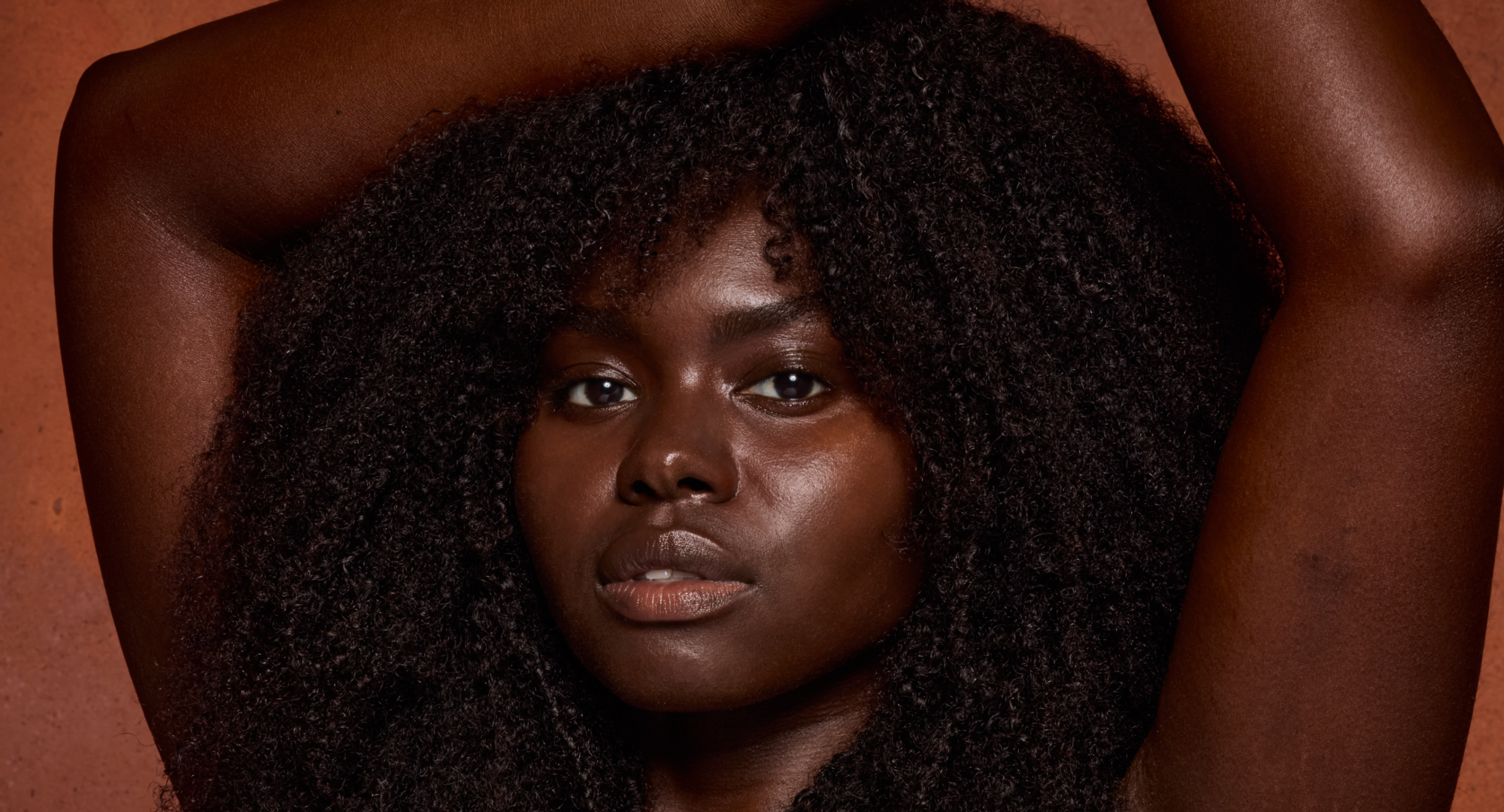 fitzpatrick skin types explained