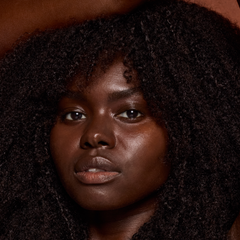 fitzpatrick skin types explained