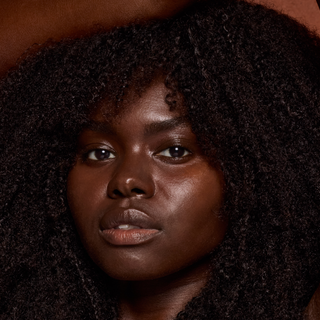 fitzpatrick skin types explained