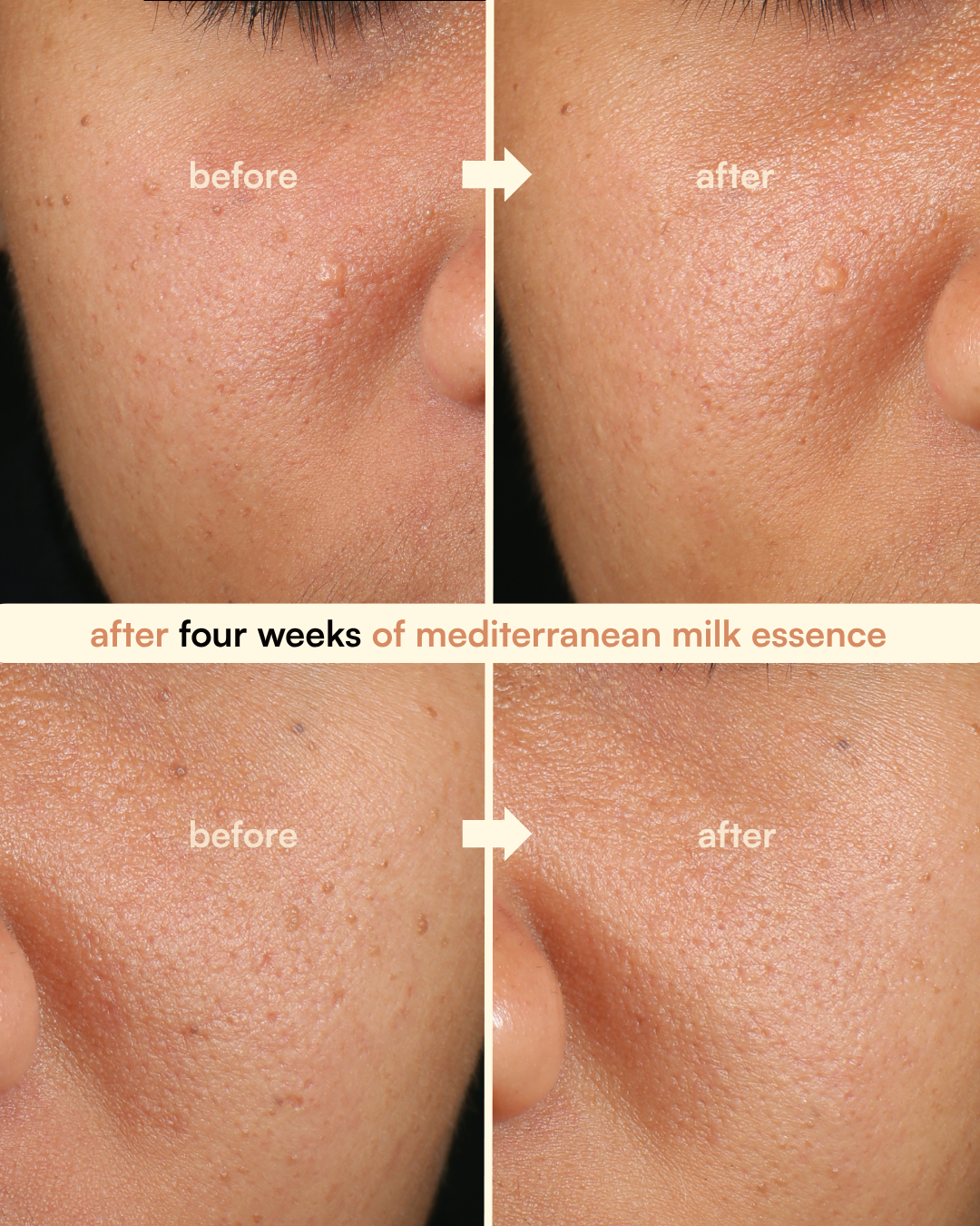 complexion correcting kit