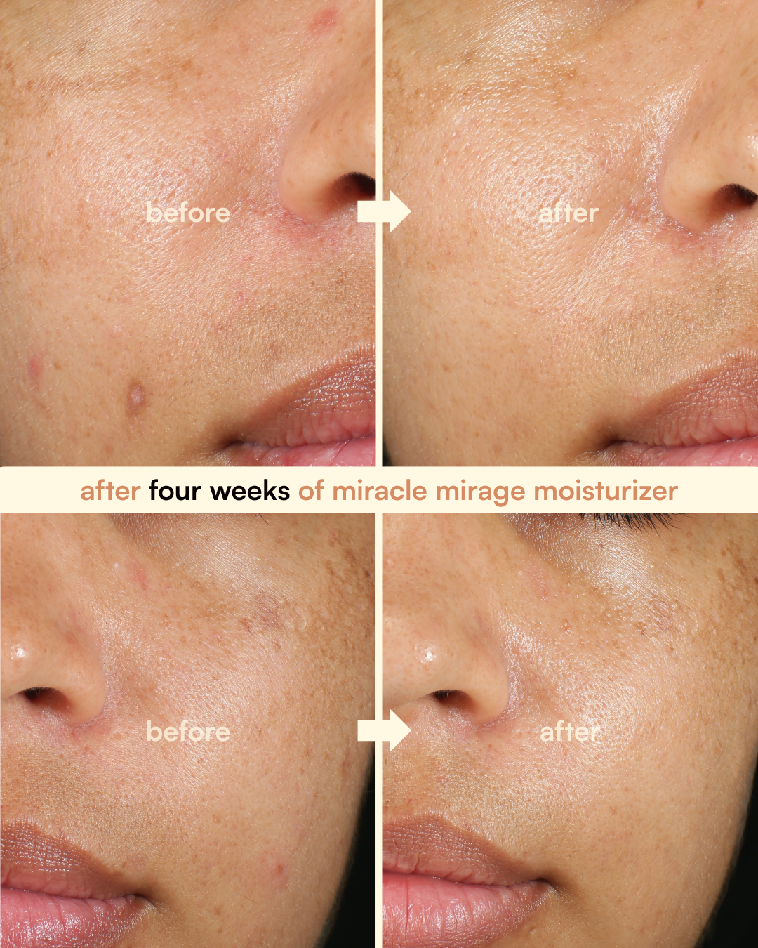 complexion correcting kit