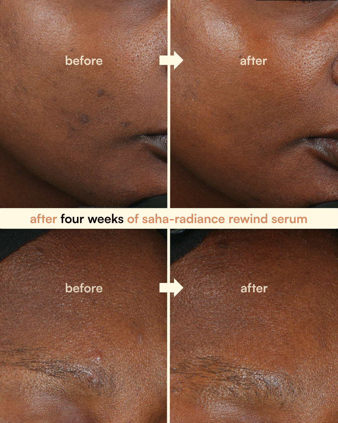 complexion correcting kit