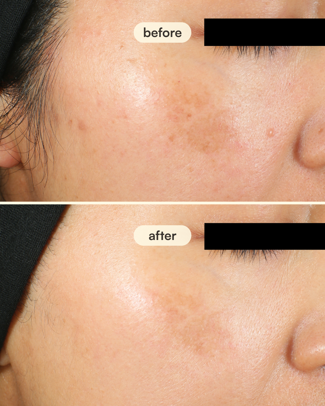 complexion correcting kit